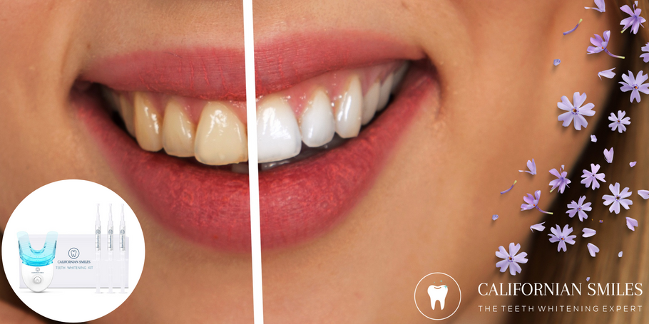 Comment le blanchiment dentaire peut-t-il transformer l’apparence ?
